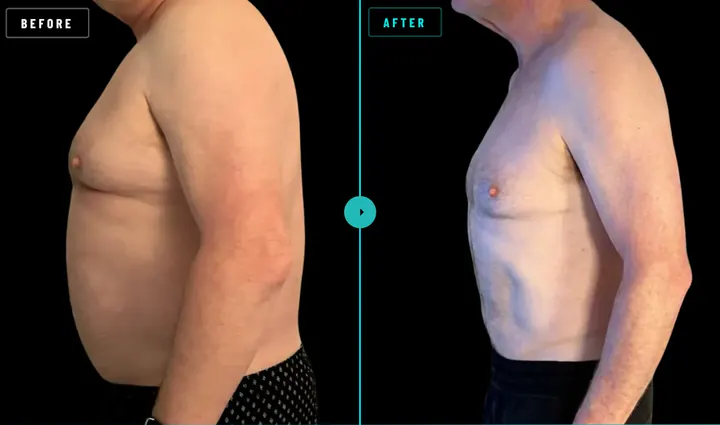 Alan, before and after: 22kg lost in 20 weeks