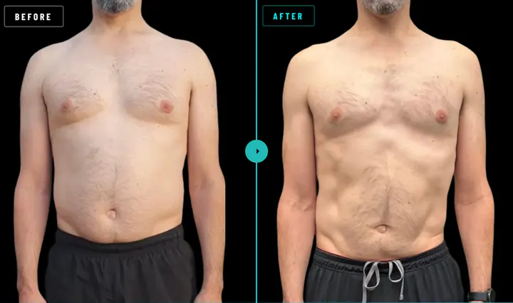 Paul, before and after: 7kg lost in 24 weeks